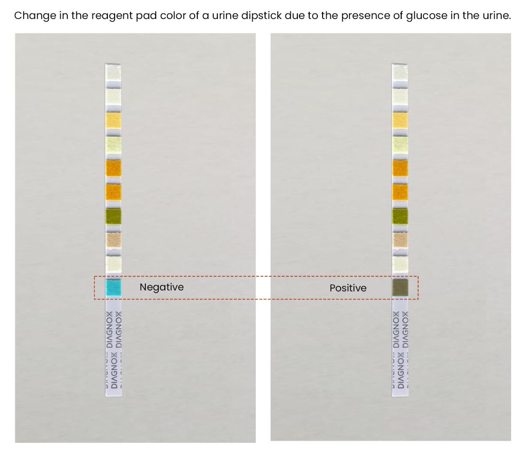 Urine Test Strips for Hassle-Free Glucose Monitoring